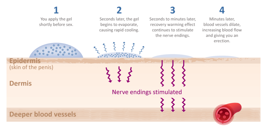 An infographic demonstrating how Eroxon gel works in 4 steps, with arrows depicting how the gel works through the epidermis, dermis and corporal tissues.